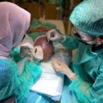 Hair transplant in Dubai (6)