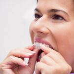 Clear Braces in Anaheim