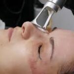 Fractional Laser CO2 in Dubai 3