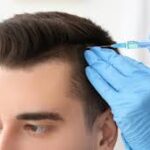 PRP hair treatment 1
